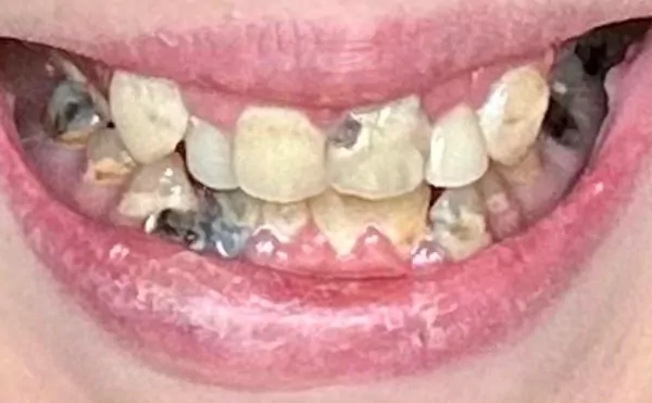 Before